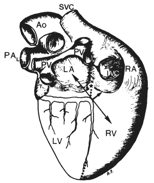 figure1